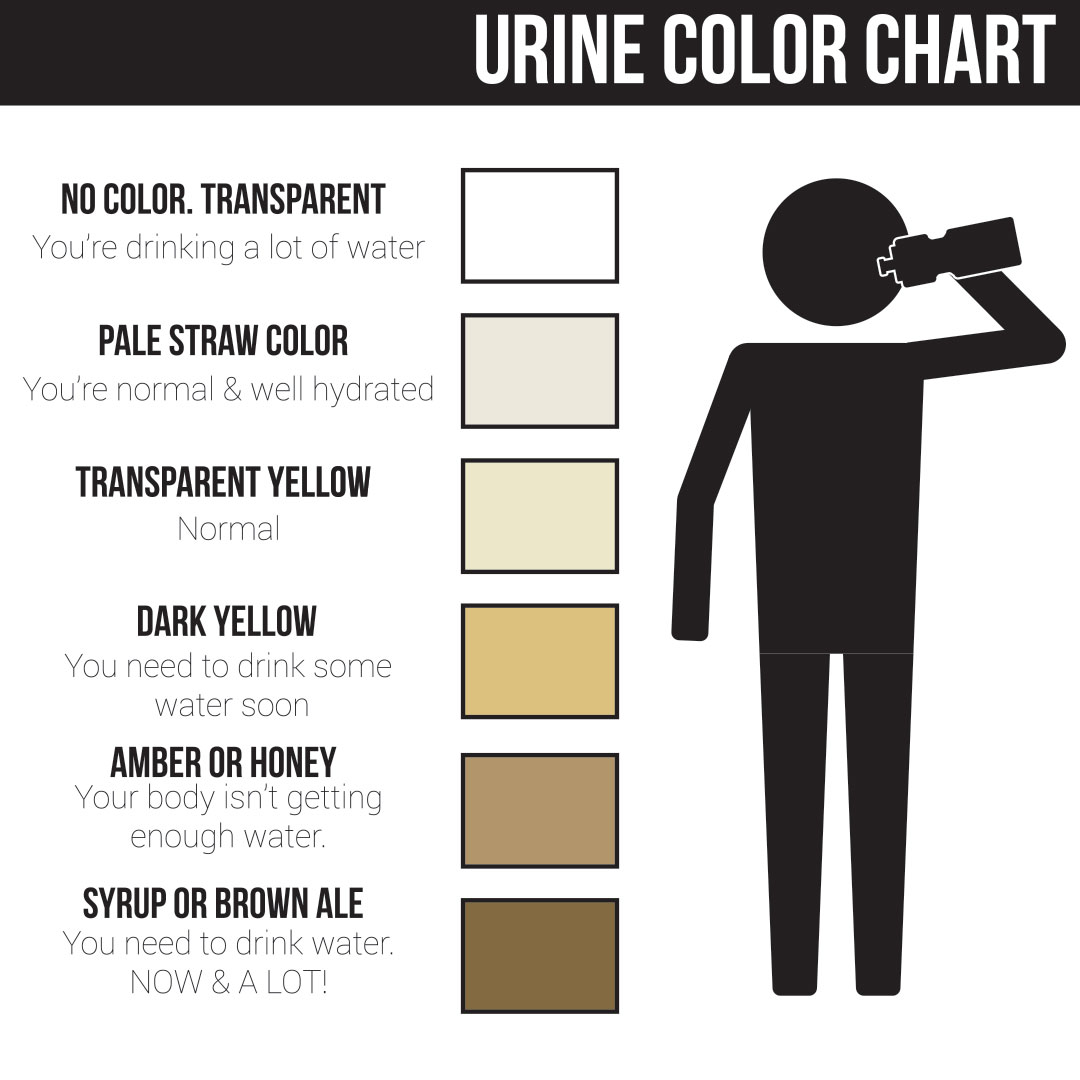 Chart showing levels of urine color during dehydration.